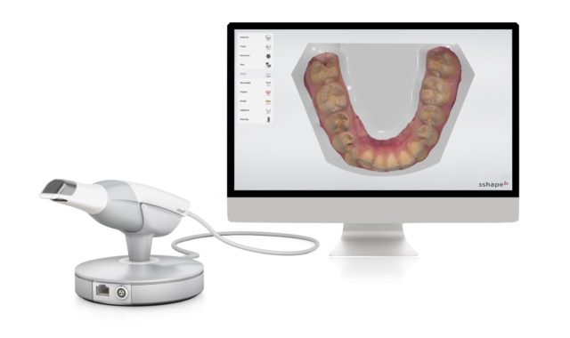 Scanner intraorale digitale 3d